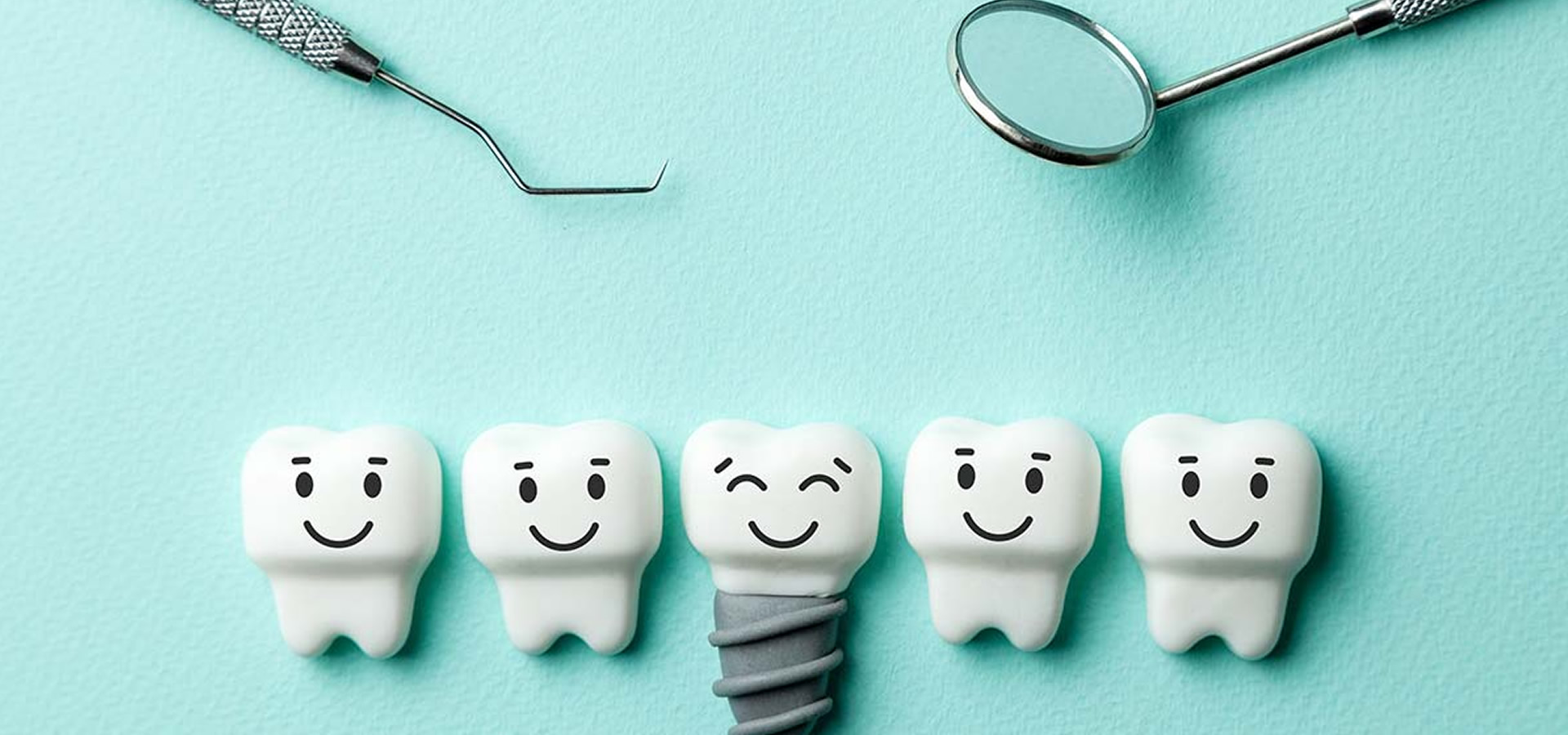 Οδοντικά Εμφυτεύματα: Μύθοι, Αλήθειες και Συμβουλές Φροντίδας